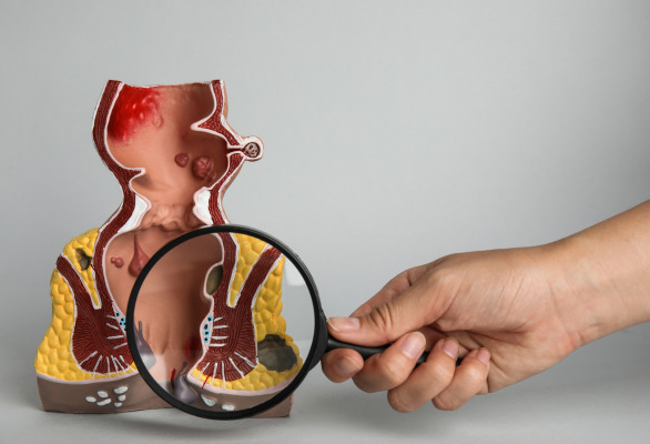 Dr.ª Paola Trindade | Coloproctologista