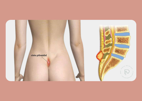 Dr.ª Paola Trindade | Coloproctologista